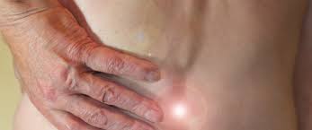 /Spinal tumors